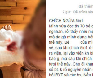 Sự thật về bức ảnh trẻ ói máu tươi sau khi tiêm vắc xin Quinvaxem