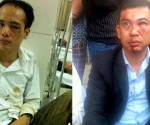Công an Hà Nội: "Không có công an xã tham gia hành hung hai luật sư"