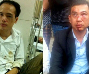 Phản ứng của luật sư bị "đánh" về kết quả điều tra của công an