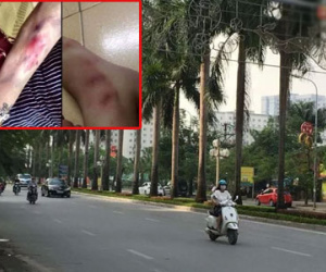 Hà Nội: Thực hư cô gái làm make-up bị cướp đánh trong đêm
