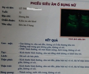 Siêu âm, một phụ nữ phát hiện bị "mất cắp" nội tạng