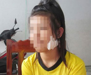 Ngăn bạn đánh nhau, nữ sinh lớp 9 bị chặn đường rạch mặt