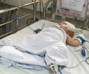 Bé trai bị dao đâm xuyên sọ hồi phục sau phẫu thuật lần 2