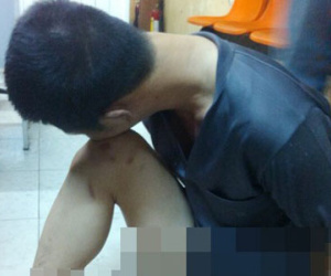 Màn giả điên của gã giang hồ tại trụ sở cảnh sát
