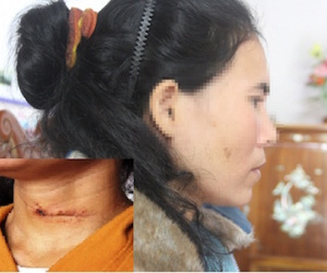 Bị chồng cắt cổ, vợ nín thở giả chết