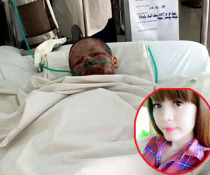 Xót thương cô gái xinh đẹp bị hủy hoại toàn bộ cơ thể do người yêu tạt xăng đốt