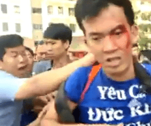 Côn đồ tấn công người dân khu chung cư cao cấp ở Sài Gòn