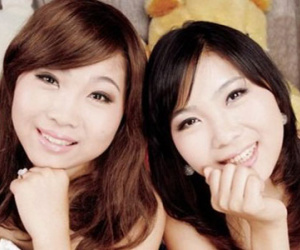 Chị em song sinh xinh đẹp hiến xác cho khoa học