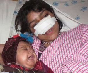 Afghanistan rúng động vì người vợ trẻ bị chồng xẻo mũi