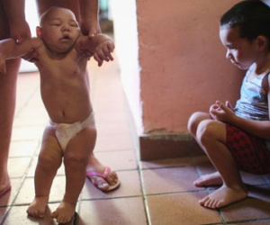 Sự thật gây sốc về virus Zika ăn não người