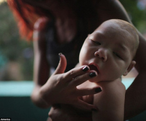 Hơn 5.000 thai phụ Colombia nhiễm virus gây bệnh đầu nhỏ