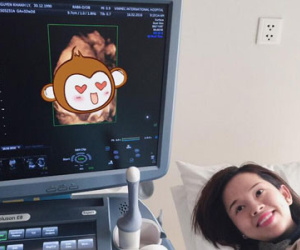 Bạn gái cũ Mạc Hồng Quân khoe ảnh siêu âm con trai