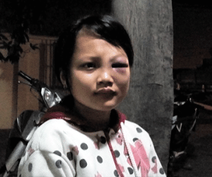 Dùng mũ bảo hiểm đánh vào mặt bé gái vì nghi trộm tiền