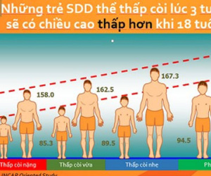 Người Việt thấp lùn do ăn mặn, thừa đạm, thiếu canxi