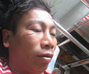 Bị chê, bí thư thôn lao vào đánh dân ngay giữa cuộc họp