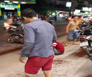 Bắt hai nghi can vụ chém đứt lìa bàn tay