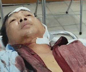 Một nhà dân ở Sài Gòn bị nhóm côn đồ hành hung dã man