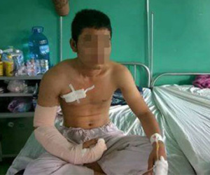 Tại sao không thể nối được bàn tay cho thanh niên bị giang hồ chém