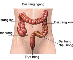 5 dấu hiệu sớm của bệnh ung thư trực tràng