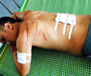 Truy sát bạn nhậu vì mâu thuẫn từ một năm trước