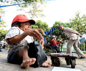 Anh em sọ dừa bán vé số ở Sài Gòn