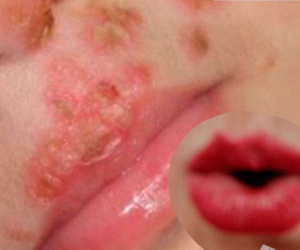 Bức ảnh “Nụ hôn Thần Chết” và sai lầm phổ biến của bậc cha mẹ