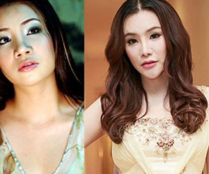 Phát hoảng khi sao Việt mê "dao kéo": Có người méo mó không ngờ