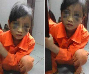Đánh tím mặt bé gái lớp 1, cô giáo khai gì?