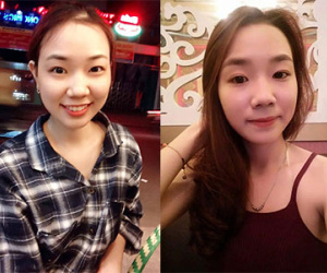 Gương mặt dễ thương của nữ sinh bị tạt axit khiến dân mạng xót xa