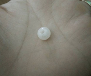 Mẹ hốt hoảng phát hiện hạt cườm trong hốc mũi con sau khi đi mẫu giáo về