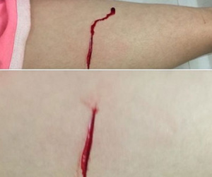 Cô gái Hà Nội bị kẻ lạ mặt rạch đùi trong đêm