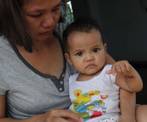 Bé gái 7 tháng tuổi thương tích đầy mình sau 1 ngày ở nhà trẻ
