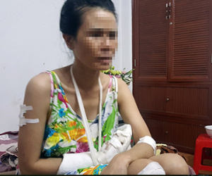 Phê ma túy đá xách dao chém đứt bàn tay người cho ở nhờ