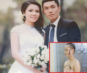 Cô gái mang hình xăm con rết thế nào sau 5 năm?