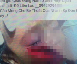 “Ngã ngửa” sự thật thông tin về em bé mồ côi cha mẹ, ngã vào lưỡi cuốc bị thương nghiêm trọng