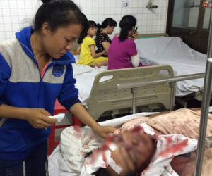 Tranh giành mua đầu trâu, người đàn ông bị đánh hội đồng chấn thương sọ não