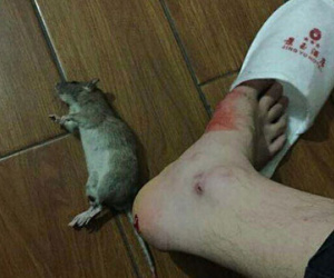Lại thêm một khách sạn gây sốc vì chuột cắn chảy máu chân khách