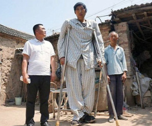 Chàng trai cao 2,4 m ở TQ vẫn tiếp tục phát triển