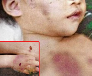 Nghi án bé 2 tuổi bị người giúp việc đánh tử vong vì không chịu ăn