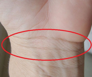 Xem ngấn cổ tay báo hiệu sức khỏe, vận mệnh tương lai