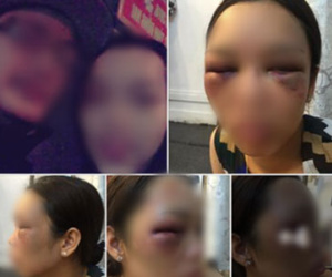 Hotgirl bị người yêu đánh ‘thừa sống thiếu chết’ vì níu kéo tình