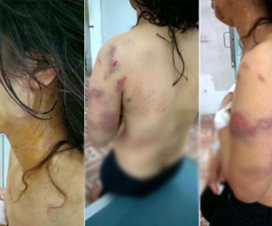 Lộ tin nhắn khiến cô giáo bị chồng cũ đánh bầm tím khắp cơ thể