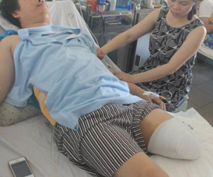 Được chẩn đoán sai khớp gối, chữa ở viện vài ngày thì "mất" chân