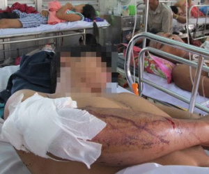 Bắt nghi can cầm đầu 20 giang hồ Sài Gòn chém 2 thanh niên