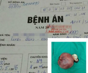Hy hữu: Bệnh nhân nam ở Hải Phòng có tử cung buồng trứng