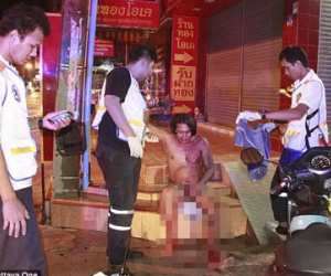 Cắt phăng "của quý" chồng vì tội ngoại tình với cô bạn thân