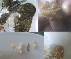Dòi lúc nhúc trong suất cơm ký túc xá ĐHQG TP HCM