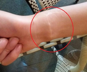 Nữ sinh viên tố bị bạn trai cưỡng hiếp, bóp cổ và dùng dao lam cắt tay bắt phải chết