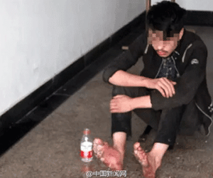 Game thủ bị thối rữa chân sau 6 ngày cắm rễ ở quán net