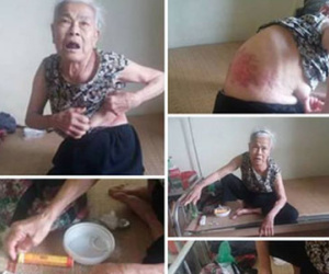 Hà Nội: Mẹ già 81 tuổi tố bị con trai út đánh gãy xương sườn, đuổi khỏi nhà